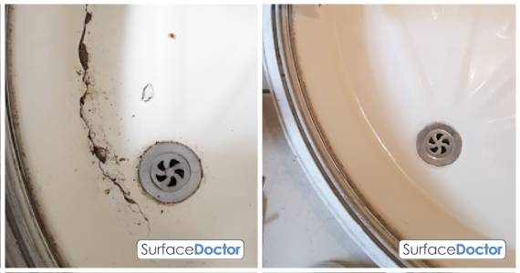 Bath enamel repair process Littlehampton